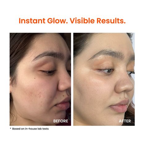 Foxtale Super Glow Moisturizer with Vitamin C