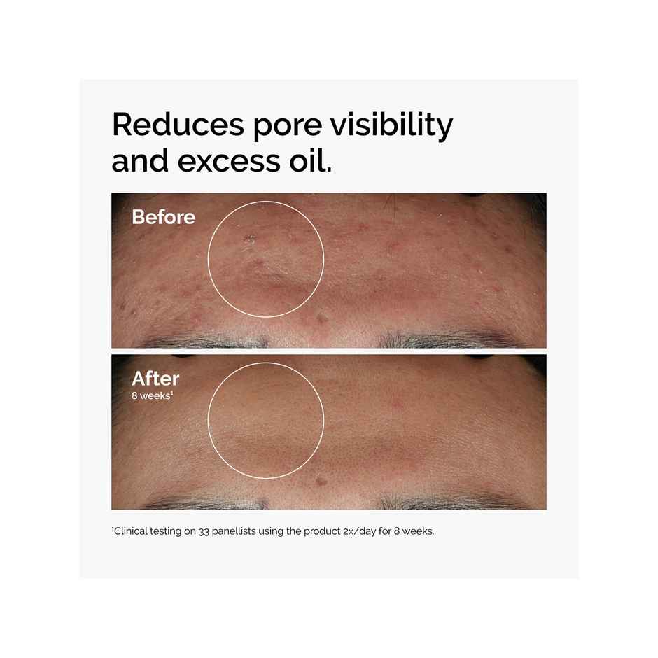 The Ordinary Niacinamide 10% + Zinc 1%