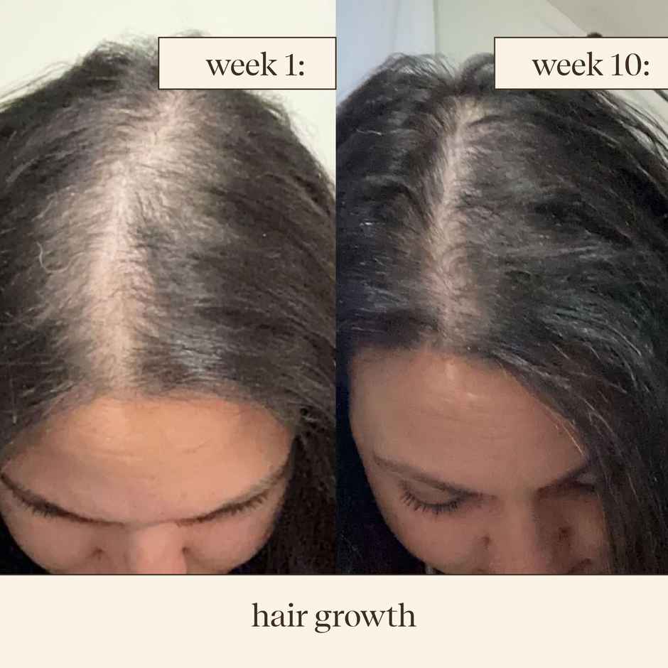 inde wild Champi Hair Oil