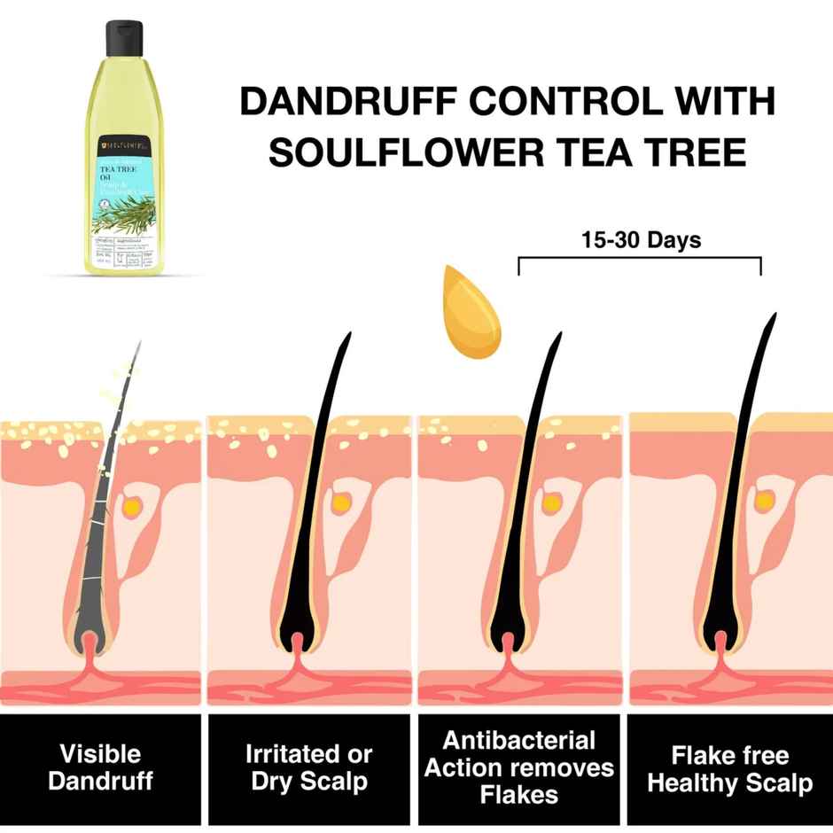 Soulflower Tea Tree Scalp and Anti Dandruff Hair Oil