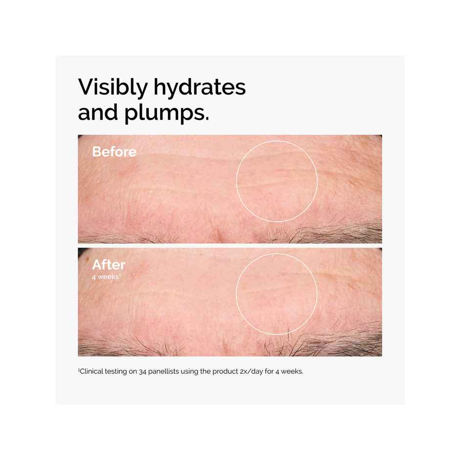 The Ordinary Hyaluronic Acid 2% + B5