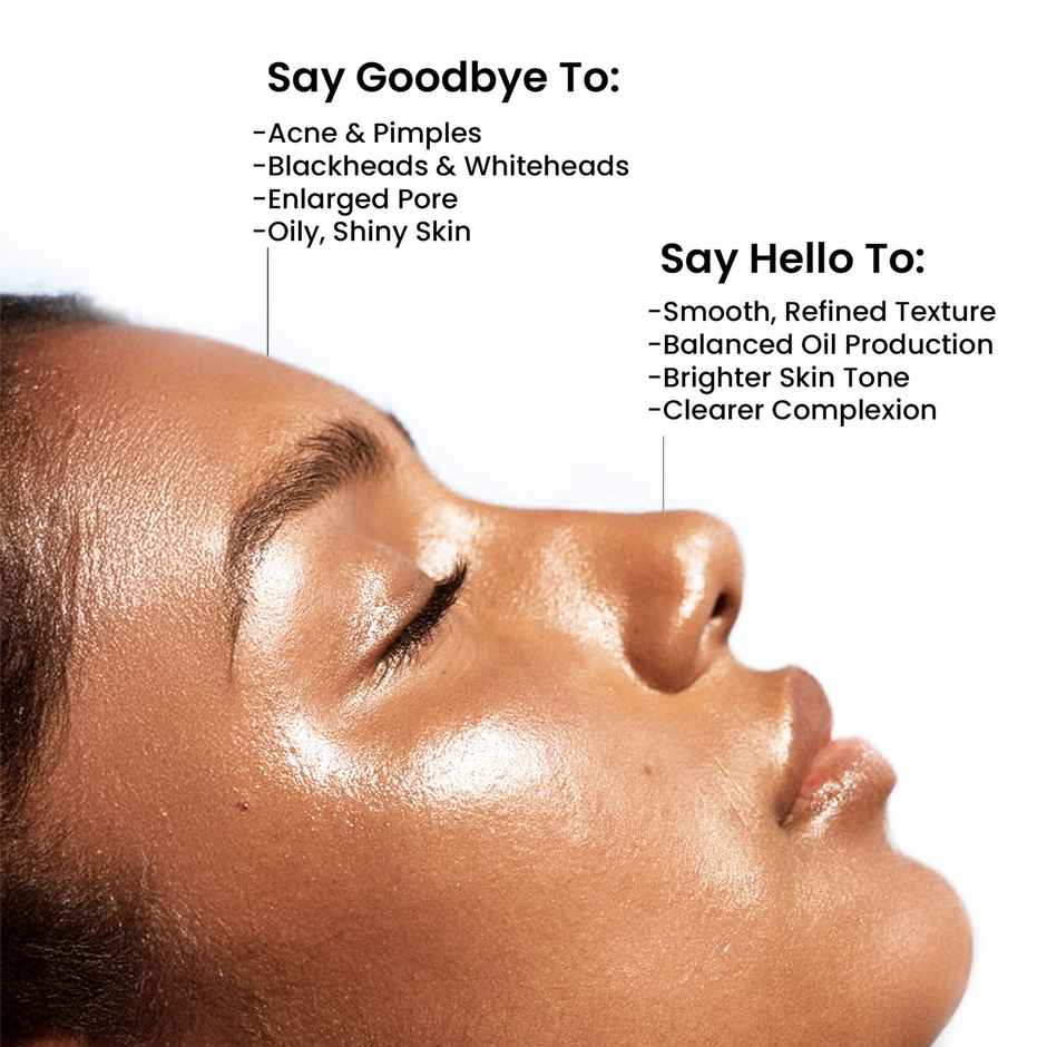 Wild Oak 2% Salicylic Mandelic Acid Exfoliating Face Serum for Acne | Oil Control & Pore Cleansing