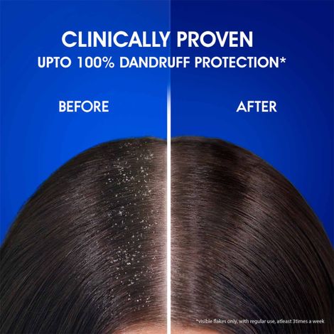 Head & Shoulders Anti-Dandruff Smooth & Silky Shampoo