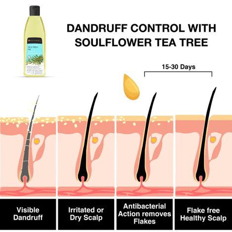 Soulflower Tea Tree Scalp and Anti Dandruff Hair Oil