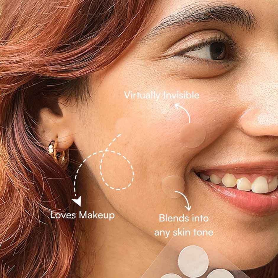 Gush Beauty Dart It Hydrocolloid Pimple Patches | For Healing Acne, Zits and Blemishes | Transparent