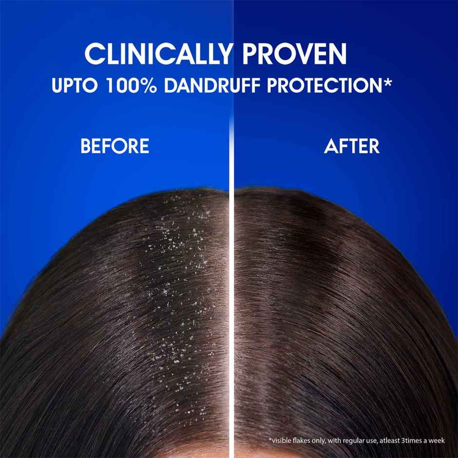 Head & Shoulders Smooth and Silky Anti Dandruff Shampoo