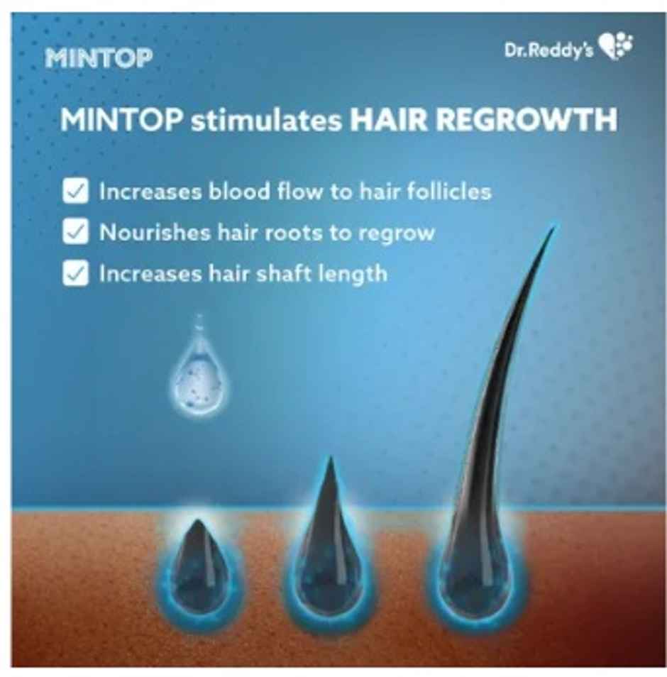 Mintop Forte 5% Topical Solution Combo