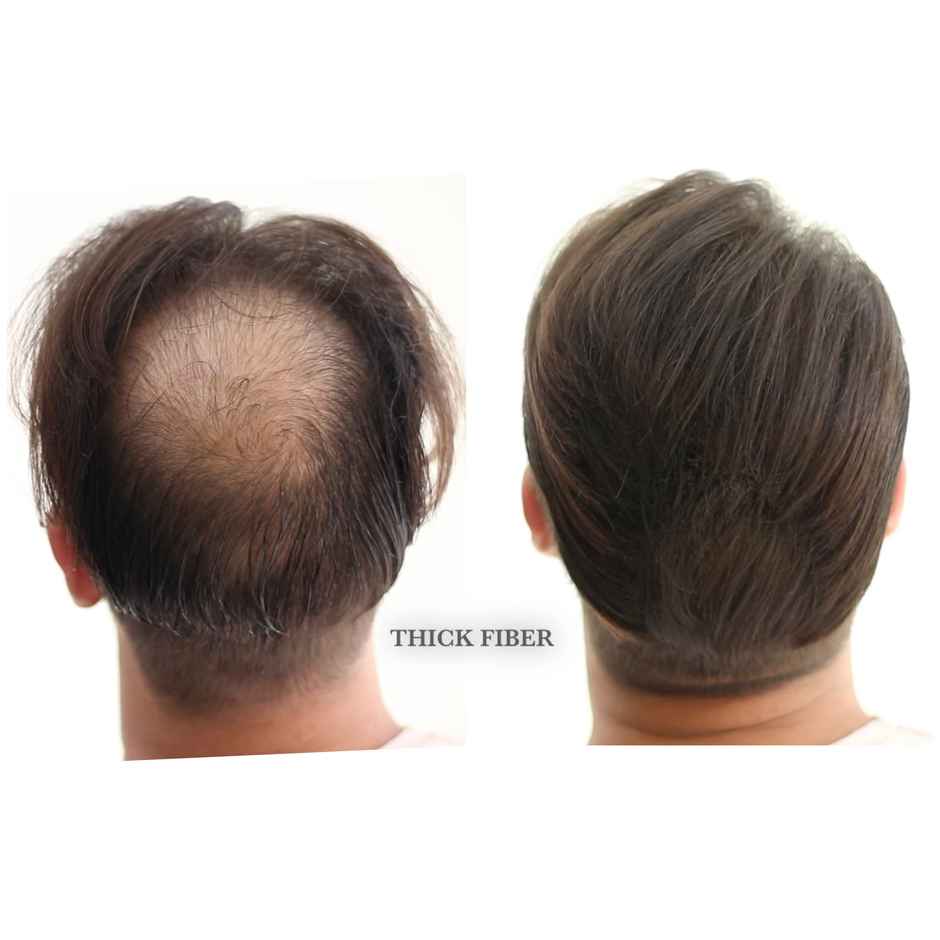 Thick Fiber Dark Brown For Thin Or Bald Spots Men And Women