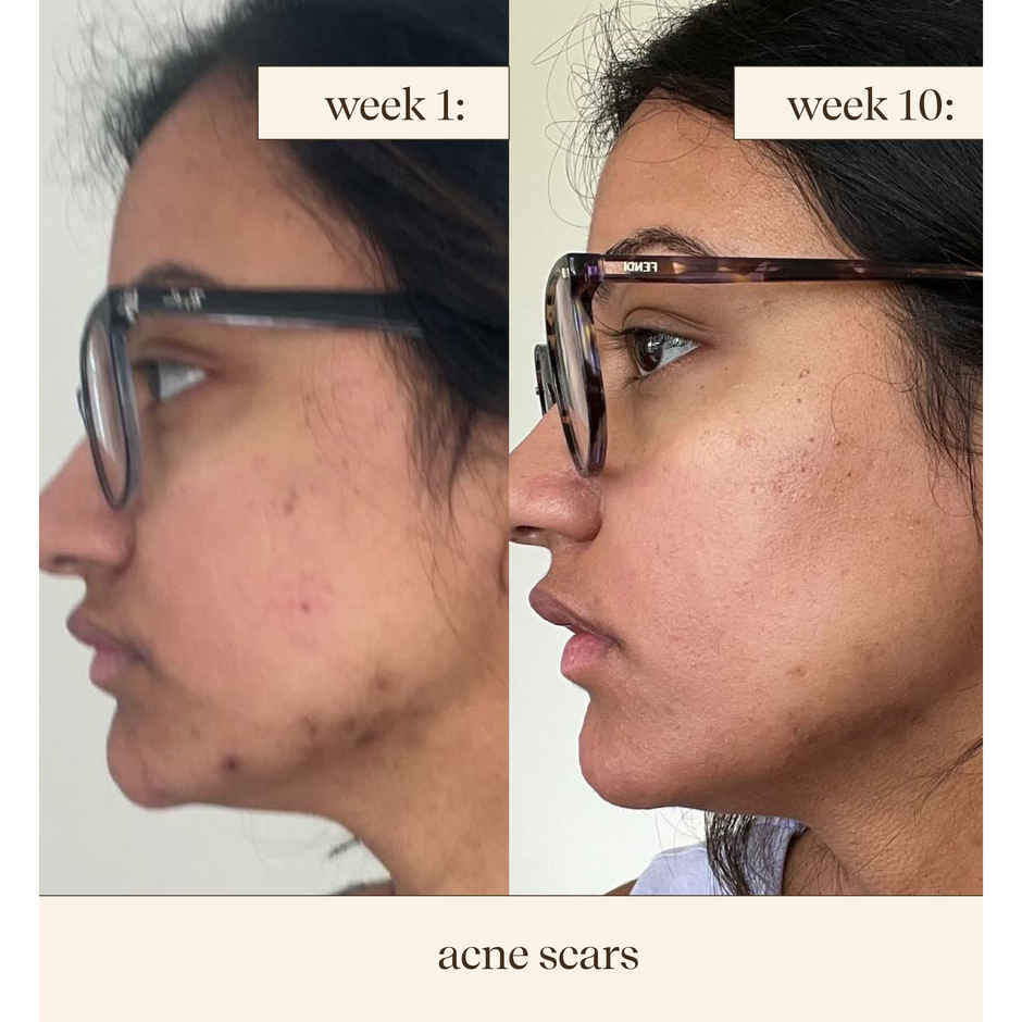 inde wild 15% Vitamin C Sunrise Glow Serum