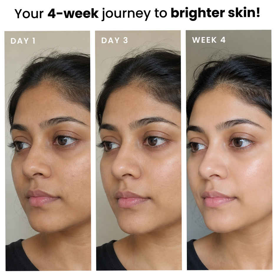 Foxtale Vitamin C Brightening Face Moisturiser