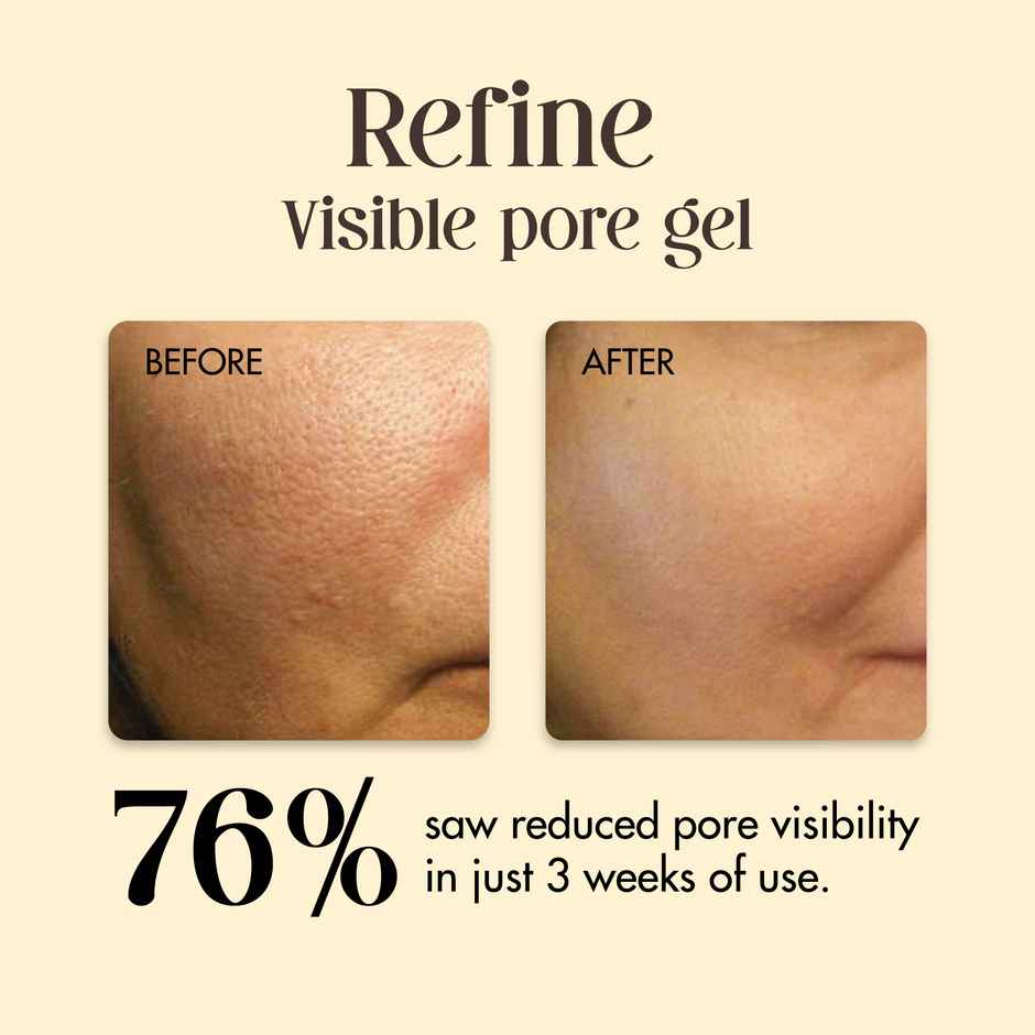 Secret Alchemist Refine Face Gel for Open Pores and Skin Tightening with Sandalwood & Cucumber