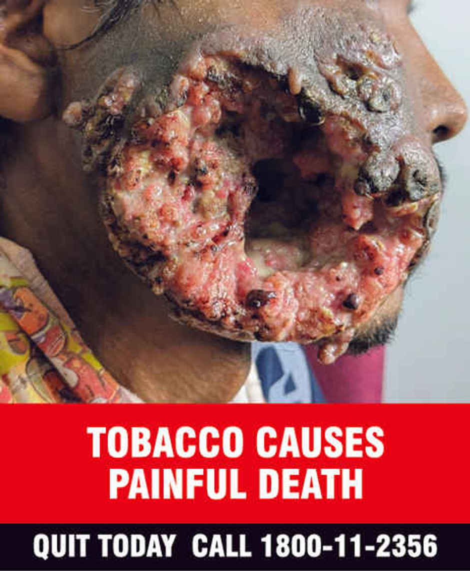 Gold Flake Red Longs