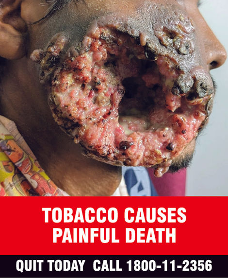 Marlboro Advance Compact