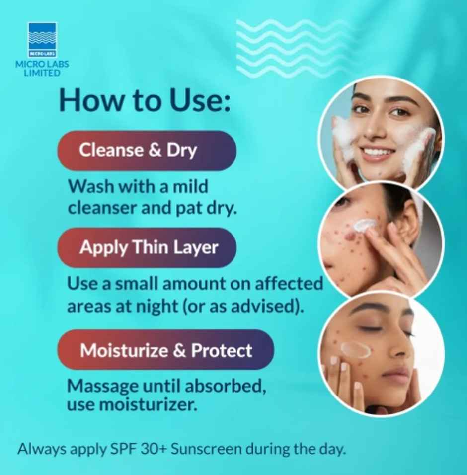 Aziderm Plus - Azelaic Acid and Glycolic Acid Cream for Oil Skin