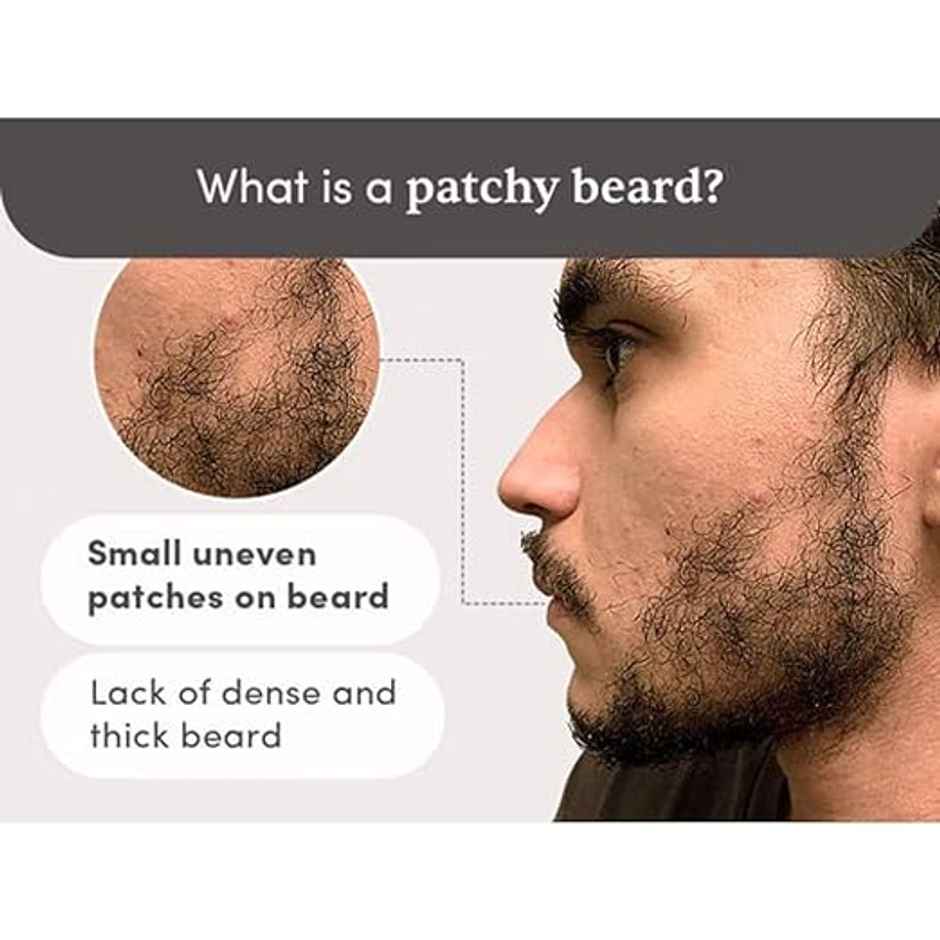 Man Matters Minoxidil 5% Beardmax Growth Serum