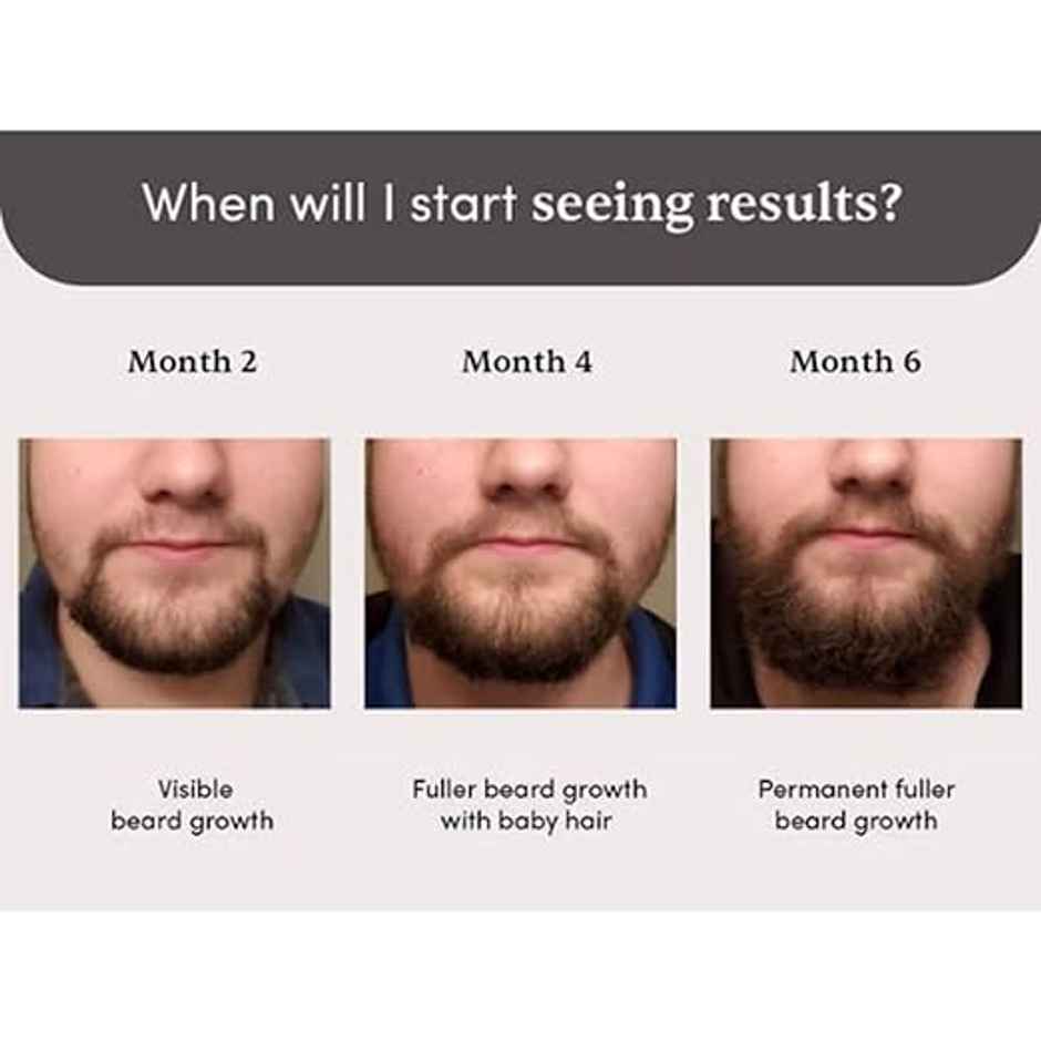 Man Matters Beardmax Growth Serum