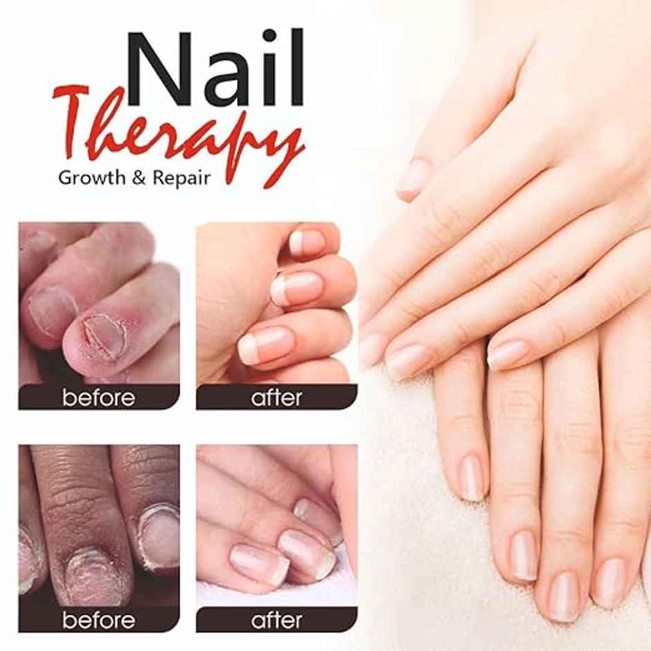 Shills Professional 12 In 1 Nail Therapy | SPN-1364