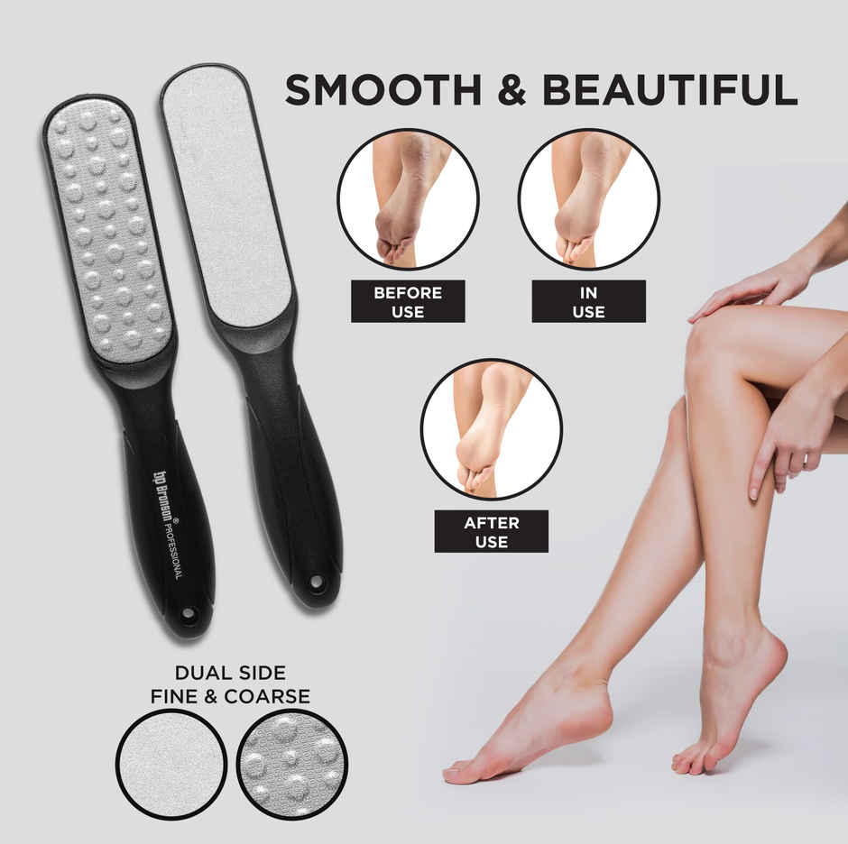 Bronson Professional Callus Remover Foot Scrubber For Pedicure Spa Treatment - Color May Vary