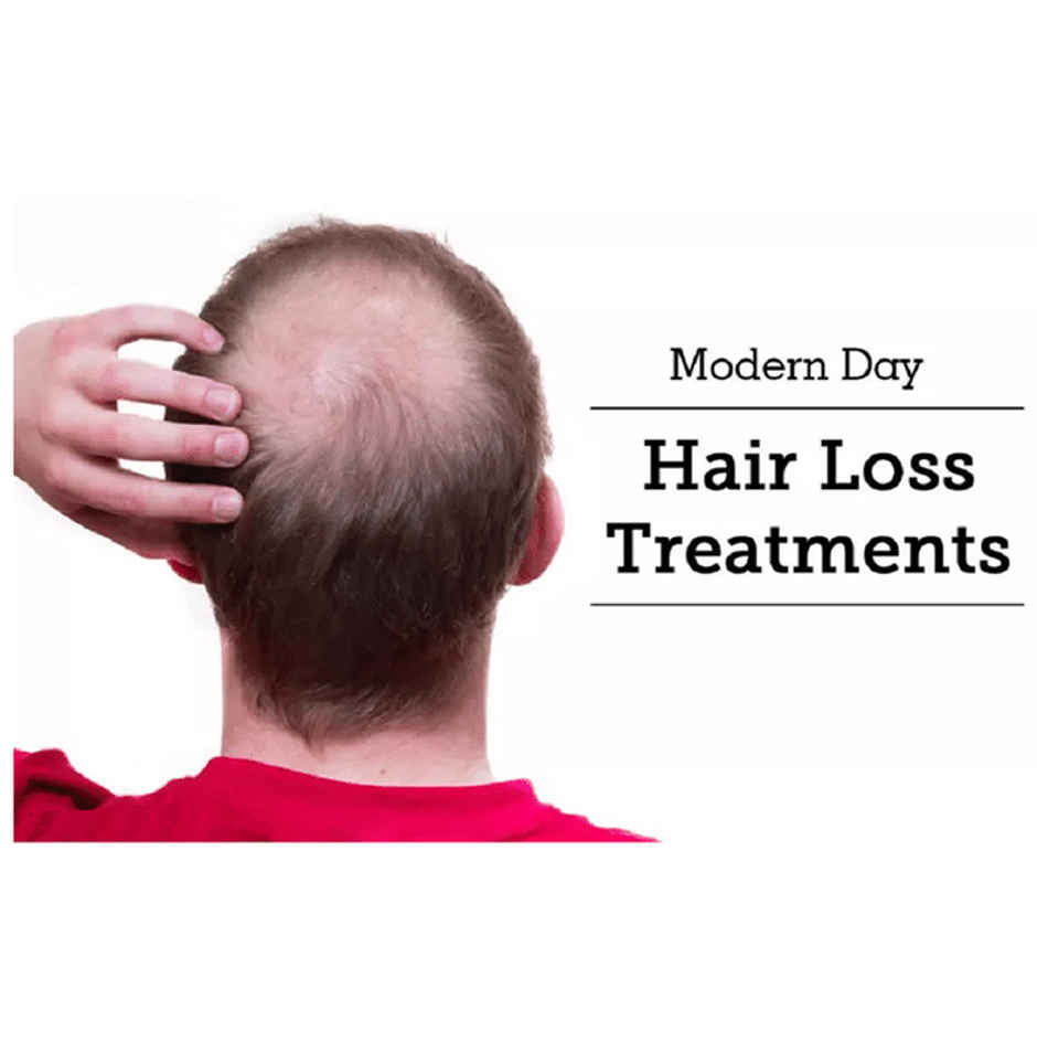 Minoqilib 5 Topical Solution