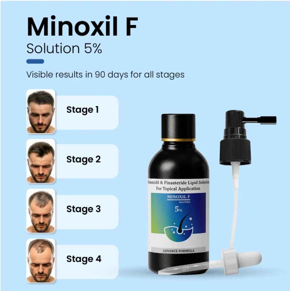 Minoxil F 5% Topical Solution