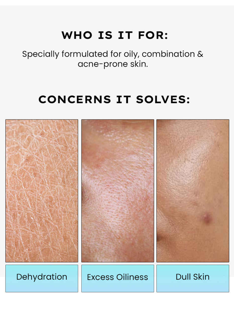 HYPHEN 2% Cica Exosomes Hydra Balance Oil free Face Moisturizer