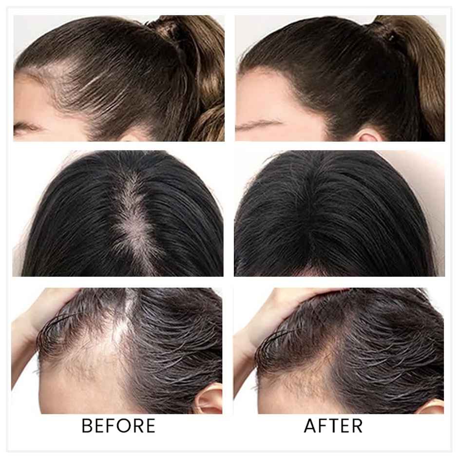 Hair Originals Hairline Powder - Root Touch Up & Hair Loss Cover Up Natural Black