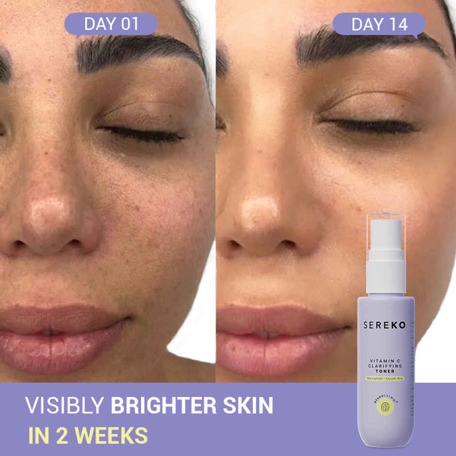 SEREKO Vitamin C Brightening Face Toner with Niacinamide, Glycolic Acid and Fruit Extracts | Works on Acne and Tightening Pores