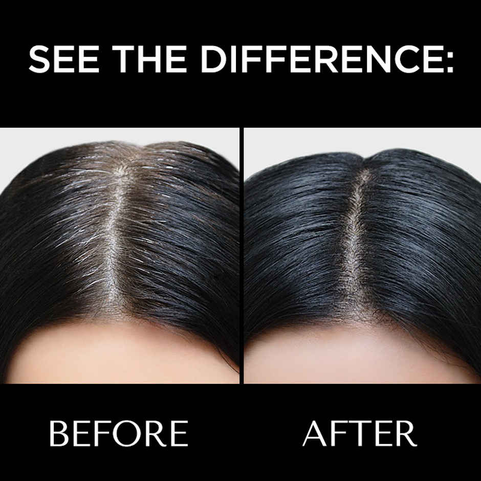 BELLAVITA Black Magic Hair Powder | Covers Grey Hair & Bald Spots Instantly | Root Touch Up