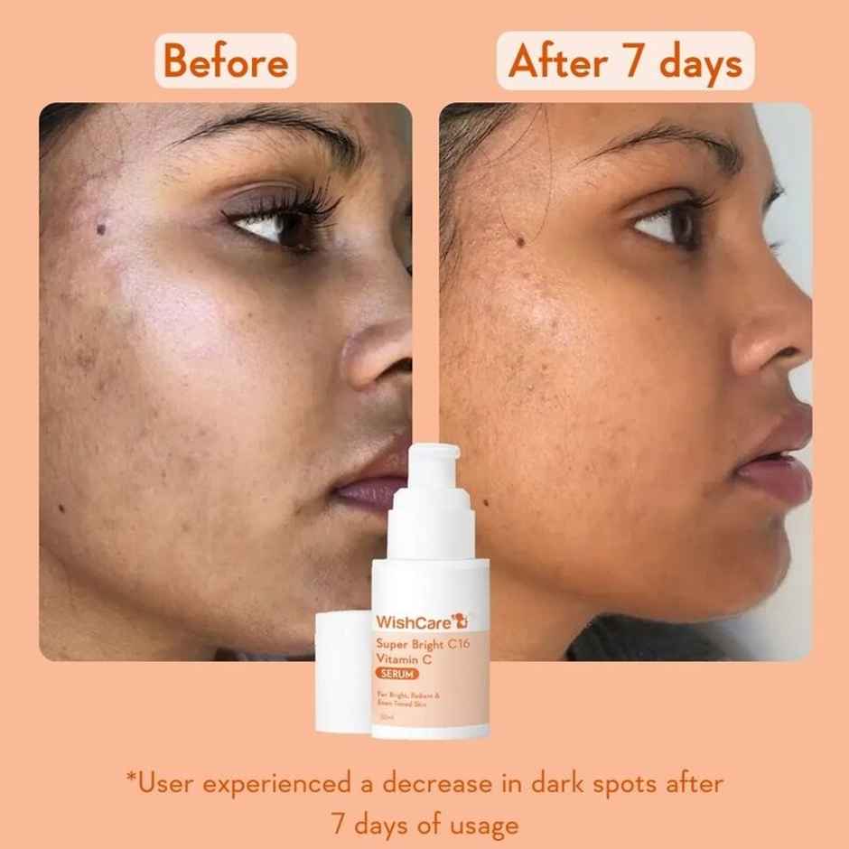 Wishcare Super Bright C16 Vitamin C Face Serum - For Pigmentation | Dark Spots