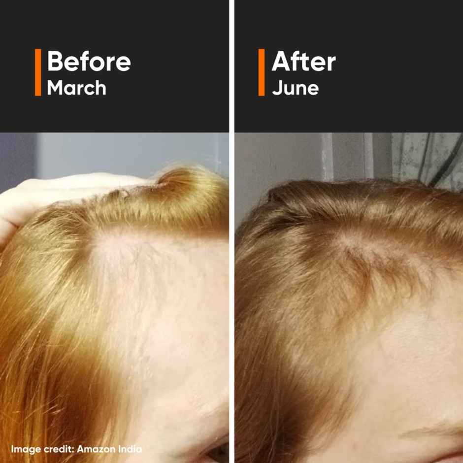 Minimalist Hair Growth Actives 18% Hair Serum