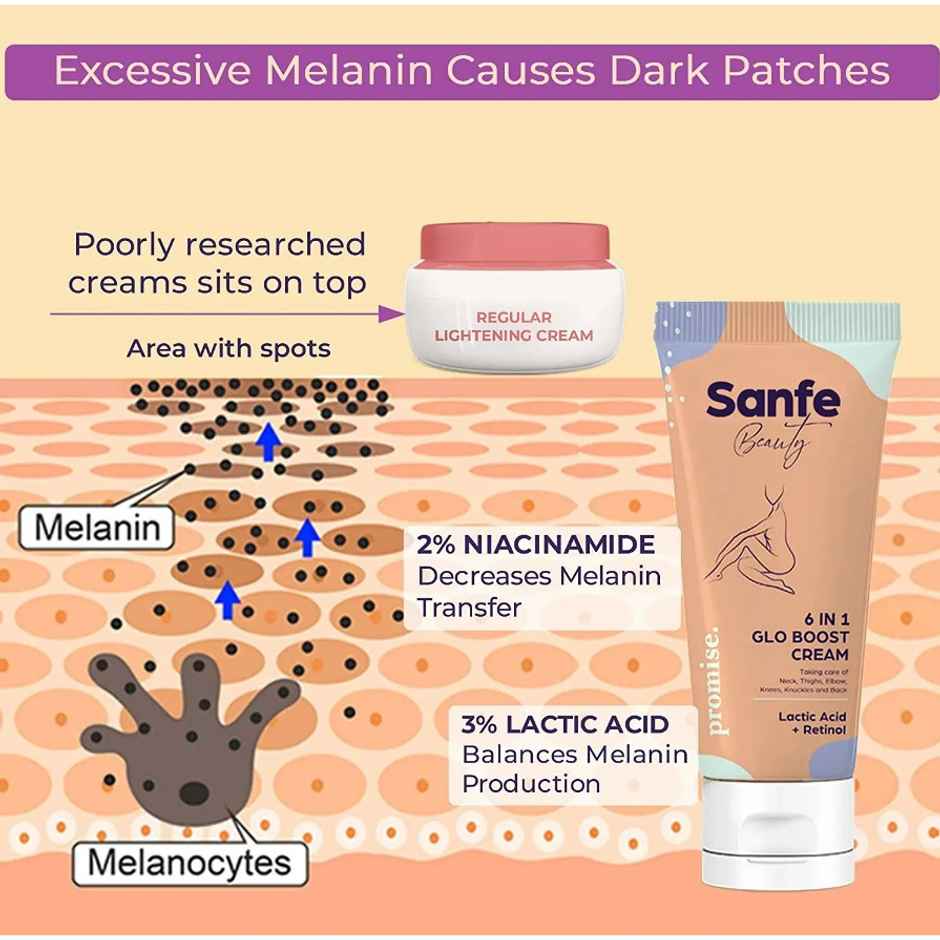 Sanfe Beauty 6-In-1 Glo Cream For Dark Body Parts Like Neck Ankles Knuckles Armpits Thighs Elbows
