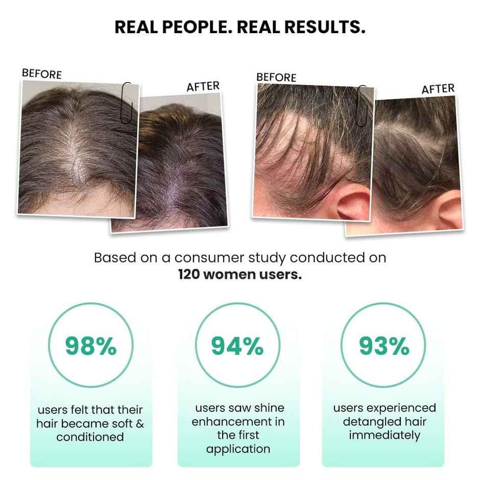 Thriveco Rosemary Water Hair Spray With 100% Natural Rosemary Extract For Men & Women,