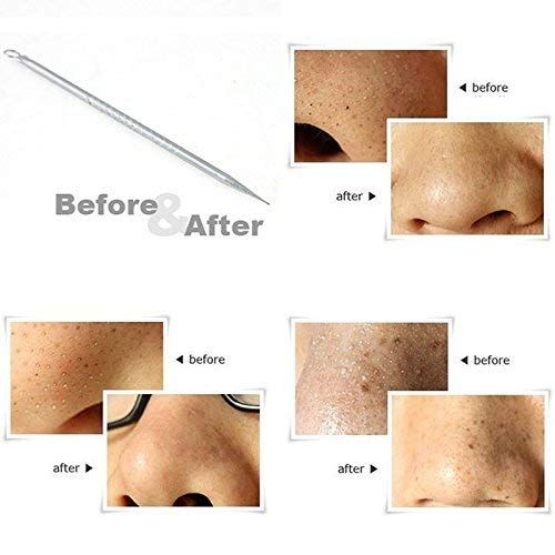 Bronson Professional Black Head Remover Tool - Pointed