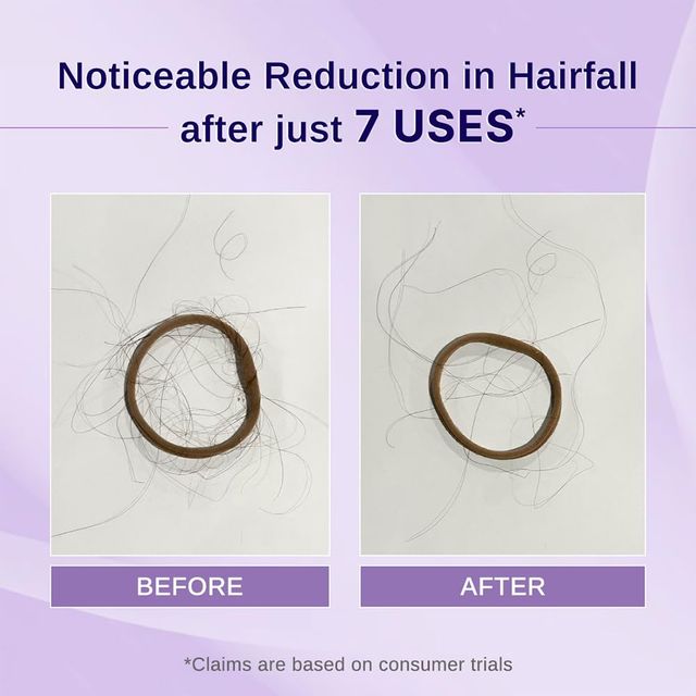 Bare Anatomy Rosemary Hibiscus Hair Growth Oil Nourishes, Strengthens & Controls Hair Fall