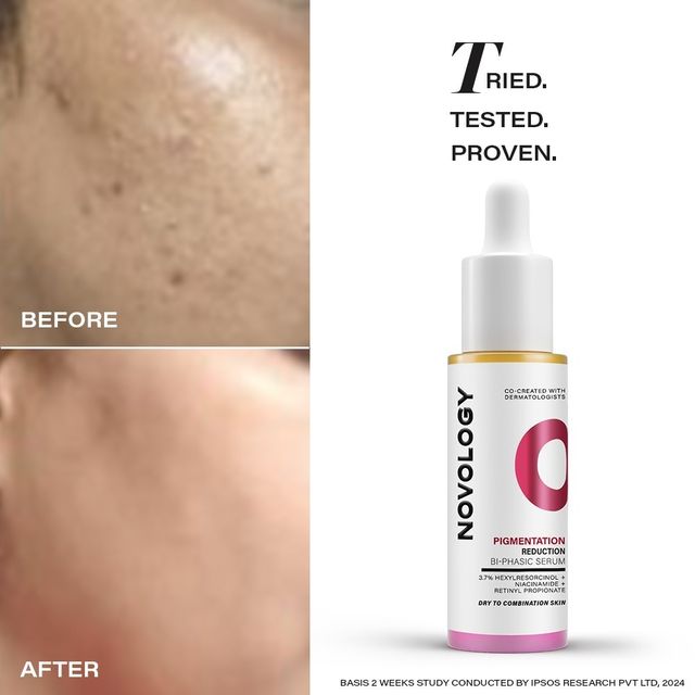 Novology Pigmentation Serum | Bi-Phasic Face Serum For Hyperpigmentation And Dark Spots