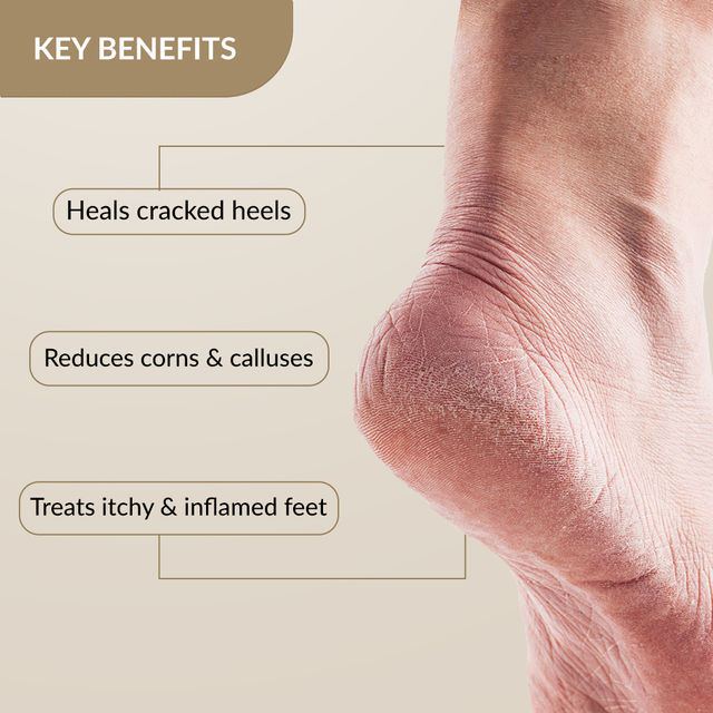 Fixderma Foobetik Foot Cream | For Cracked Heel Repair & Moisturizing Relief