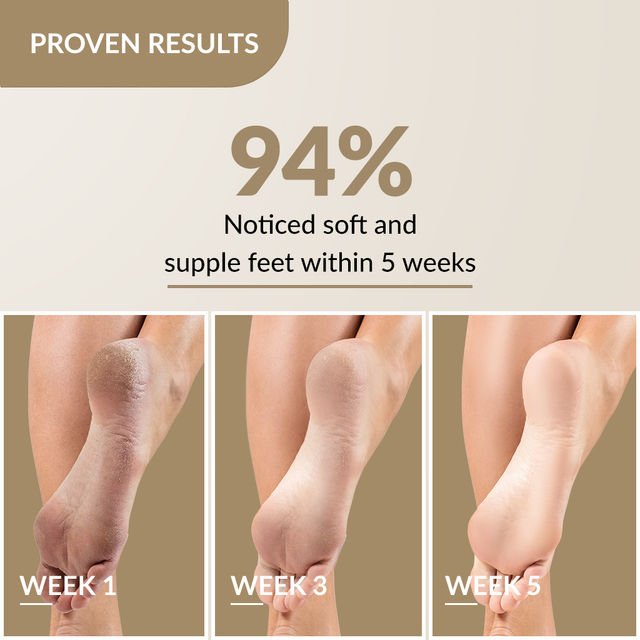Fixderma Foobetik Foot Cream | For Cracked Heel Repair & Moisturizing Relief