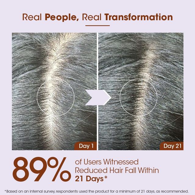 Tac Rosemary Anti-Hair Fall Conditioner With Mint & Clove Oil Combats Hair Fall