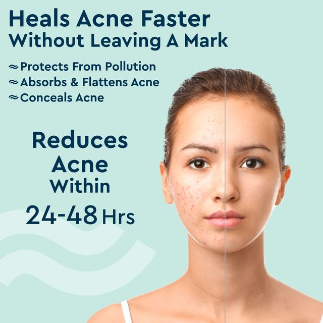 GUBB Face Acne Patch Pimple Healing Patch Absorbing Cover Invisible, Blemish Spot, Hydrocolloid