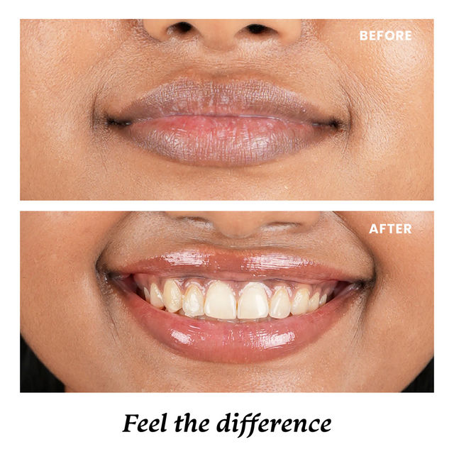 Foxtale SPF 30 Brightening Lip Balm with Peptitdes