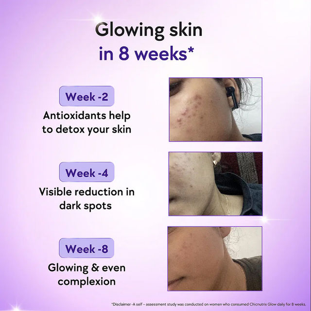 Chicnutrix Glow Japanese Glutathione & Vit. C for Brighter Skin| Strawberry-Lemon flavour