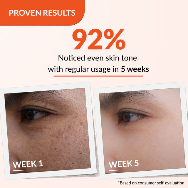 Fixderma Skarfix-TX Face Cream with Tranexamic, Kojic & Arbutin | For Pigmentation & Melasma