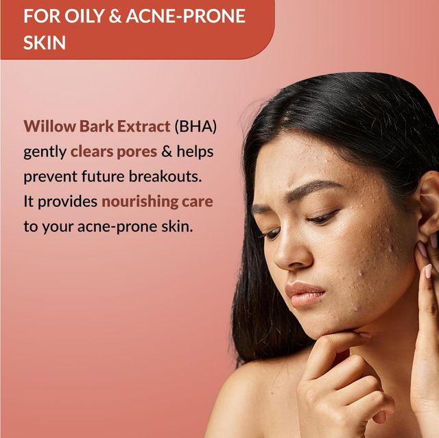 Fixderma Durave Acne Control Moisturizer | Oil-Free with Glycolic Acid