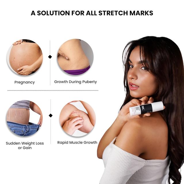 Thriveco Stretch Marks Expert Serum Cream For Men & Women