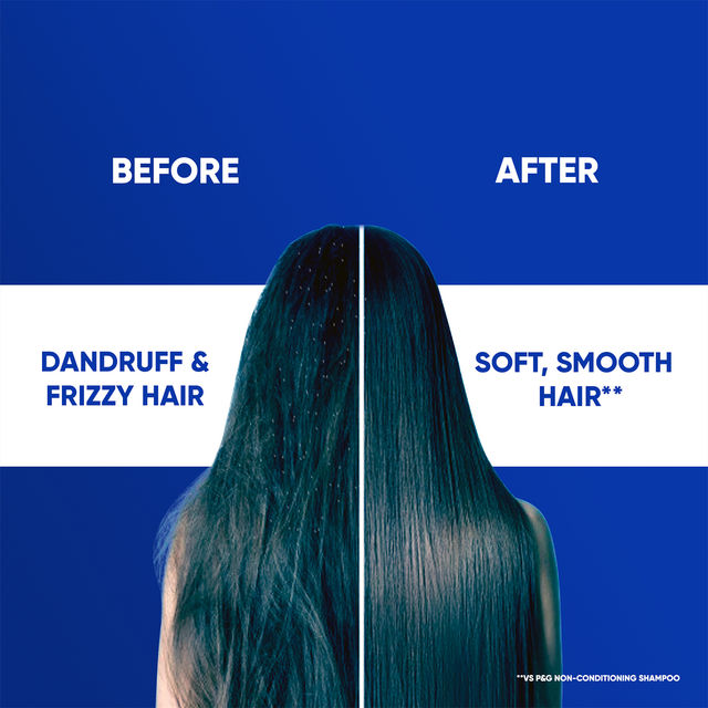 Head & Shoulders 2-In-1 Smooth And Silky Anti Dandruff Shampoo + Conditioner For Women & Men