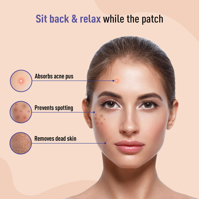 Sirona Acne Pimple Patch For Face For All Skin Types