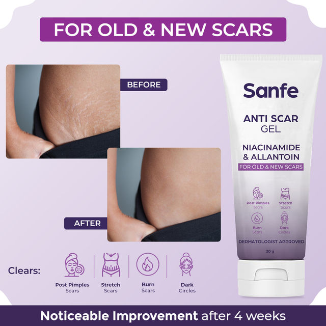 Sanfe Anti Scar Gel - Niacinamide & Allantoin Acne/Stretch/Burn scars/Dark circles removal cream