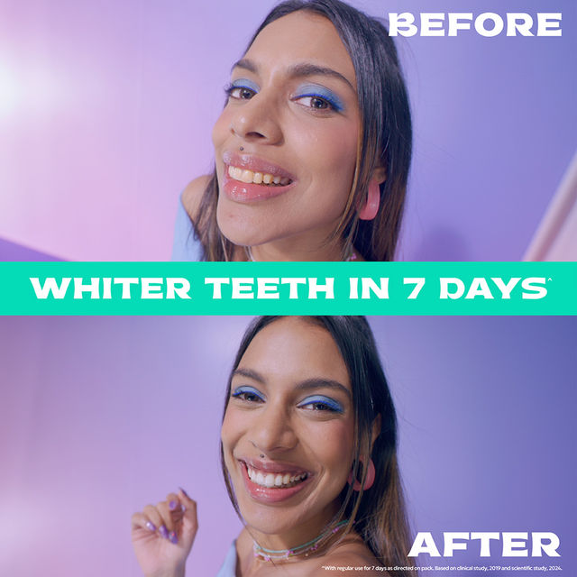 Closeup White Now Stain Eraser Toothpaste