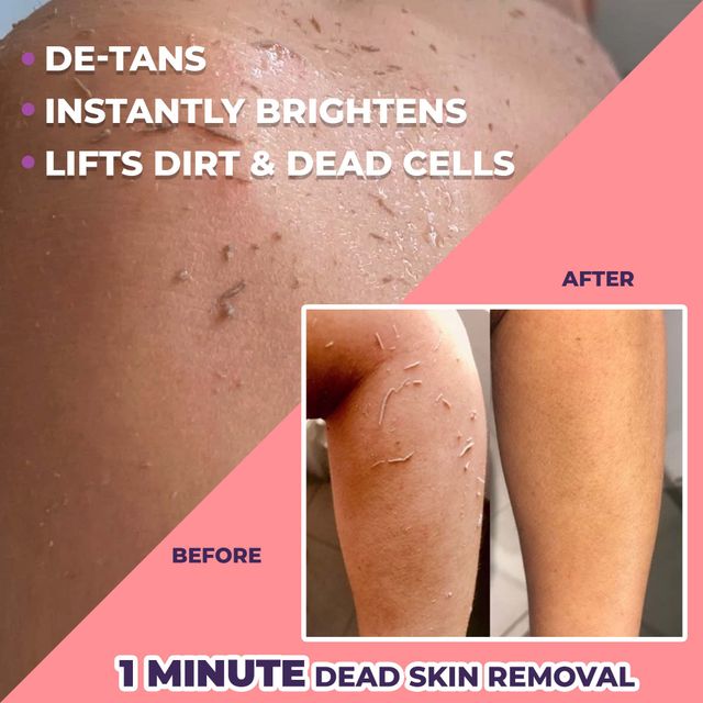 Sanfe Kesar Instant Glow Exfoliating Gel - Visibly Removes Tan, Brighten Skin, Aha Exfoliation