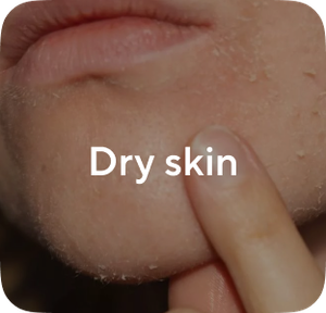 Dry skin